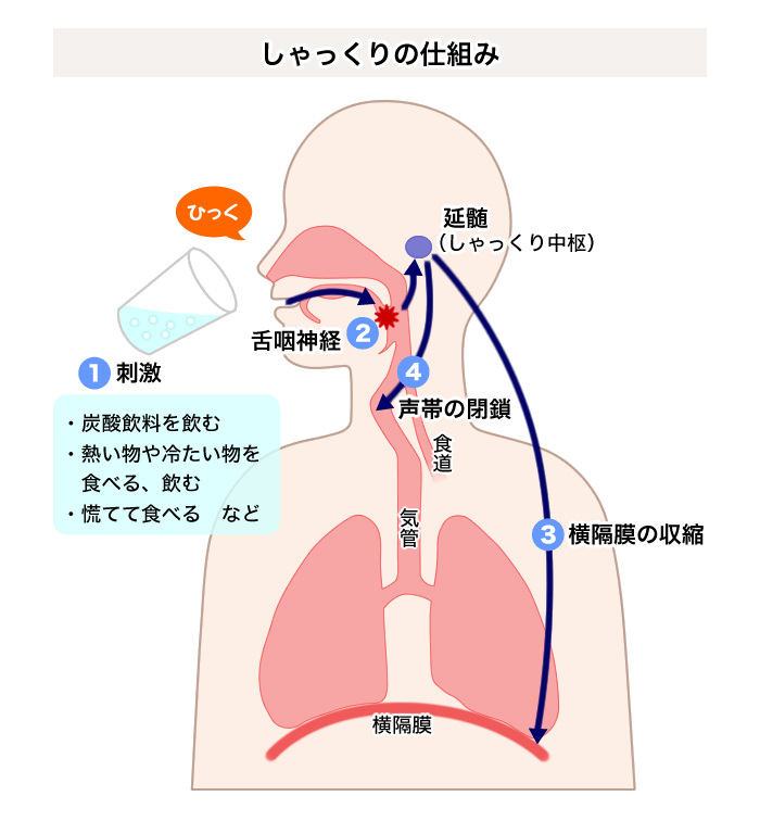 しゃっくりの原因引用画像