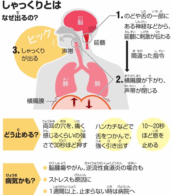 しゃっくりがもたらす影響と止め方引用画像